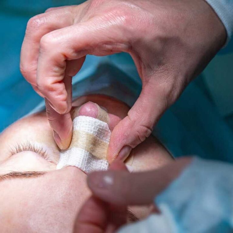 Rinomodelación: no debe realizarse si te planteas una cirugía de Rinoplastia